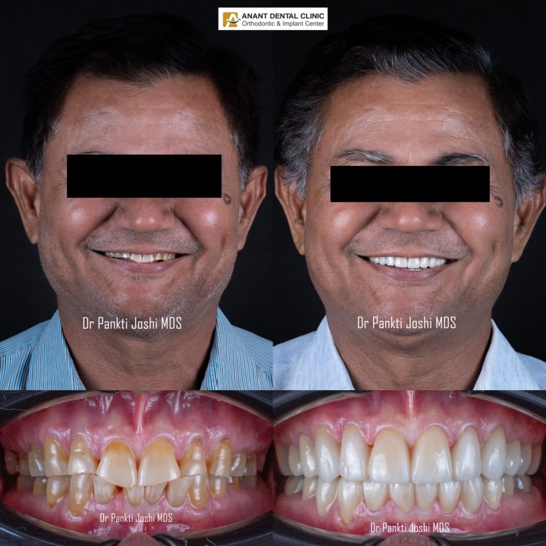 collage_export_2283F71D-8781-4848-808B-88B40DBB870B