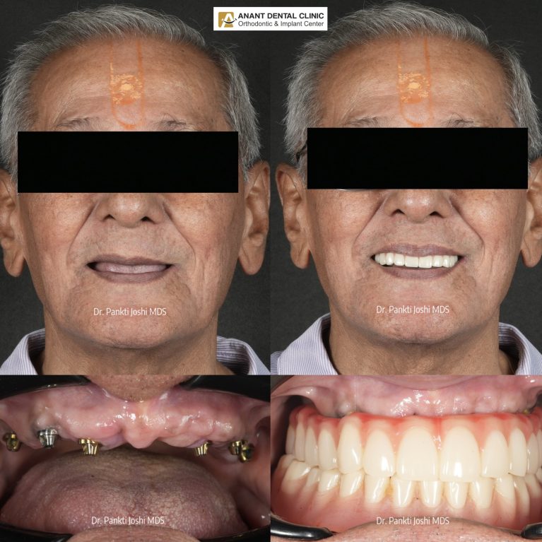 collage_export_50E919CD-FD33-4F22-85D0-912569E50119